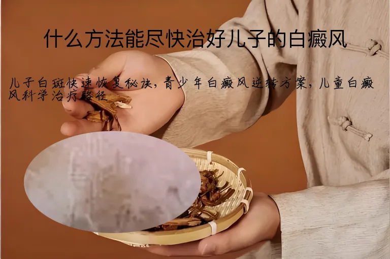 什么方法能尽快治好儿子的白癜风