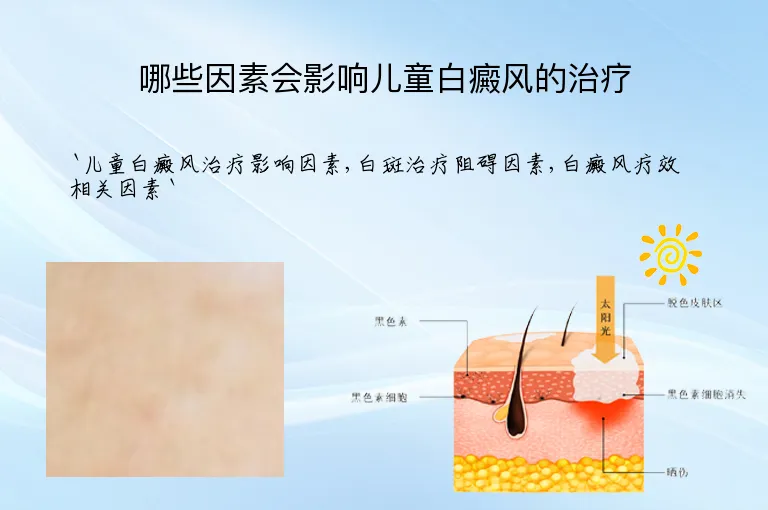 哪些因素会影响儿童白癜风的治疗