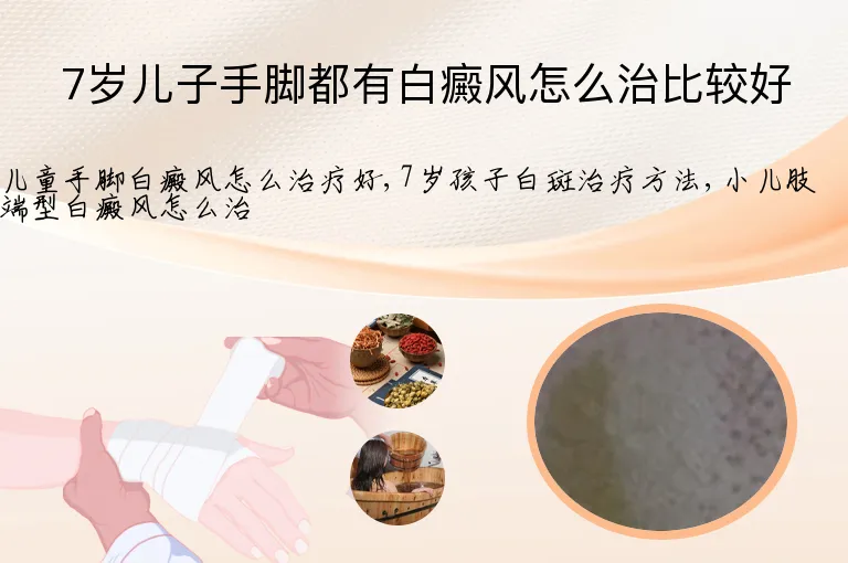 7岁儿子手脚都有白癜风怎么治比较好