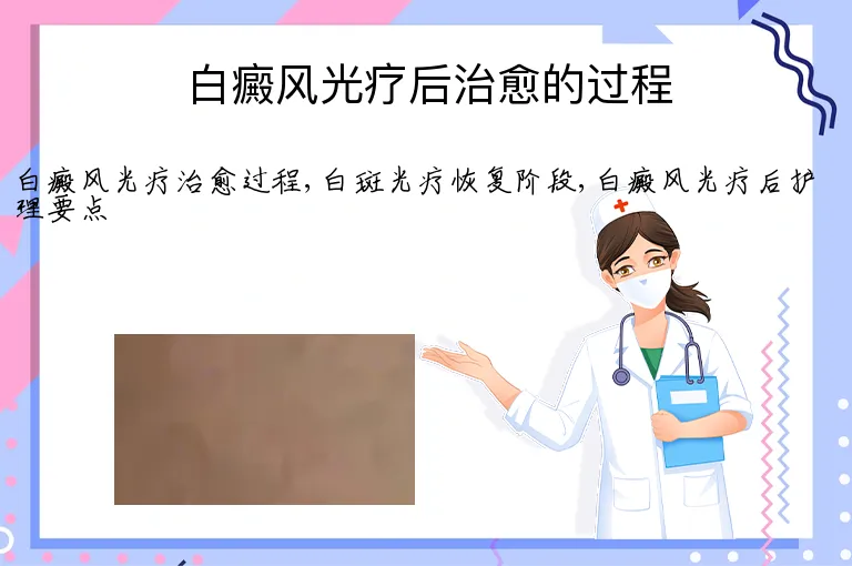 白癜风光疗后治愈的过程