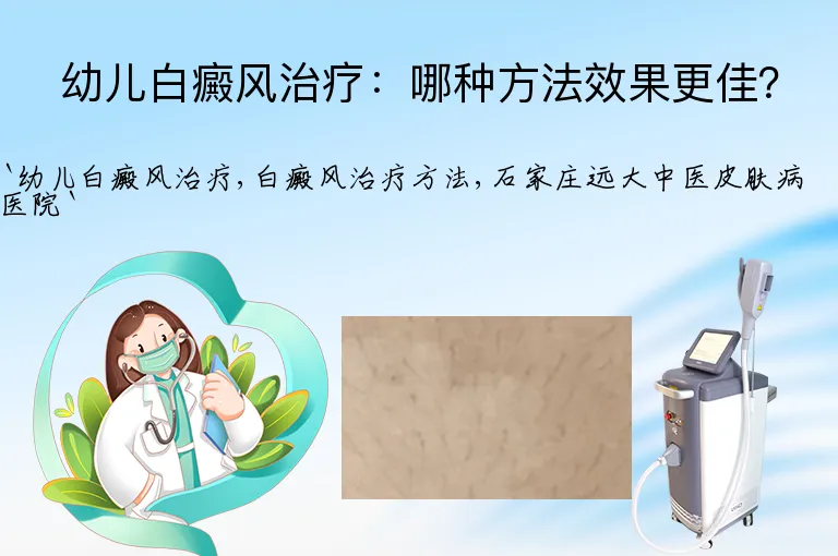 幼儿白癜风治疗：哪种方法效果更佳？