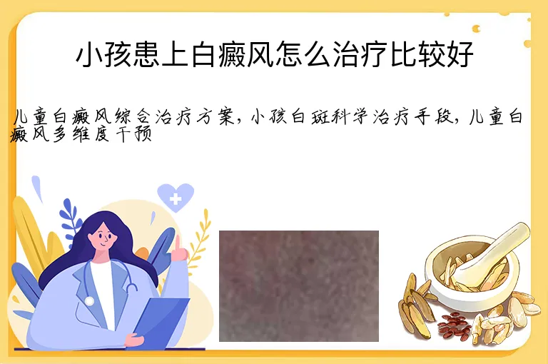 小孩患上白癜风怎么治疗比较好