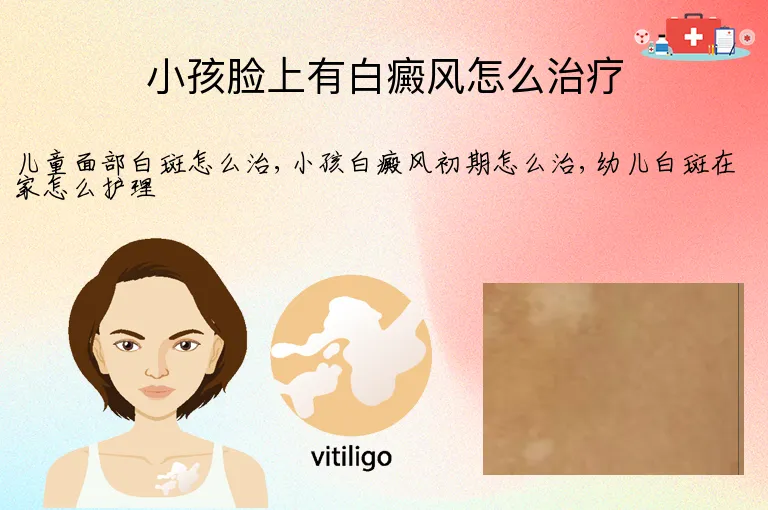 小孩脸上有白癜风怎么治疗