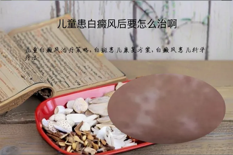 儿童患白癜风后要怎么治啊