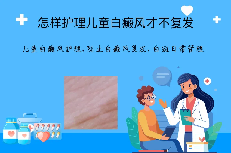 怎样护理儿童白癜风才不复发