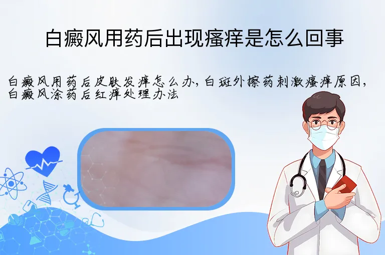 白癜风用药后出现瘙痒是怎么回事