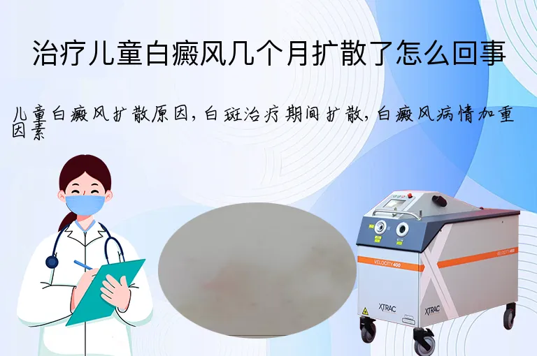 治疗儿童白癜风几个月扩散了怎么回事