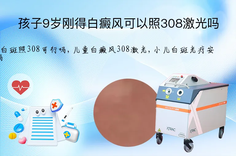 孩子9岁刚得白癜风可以照308激光吗