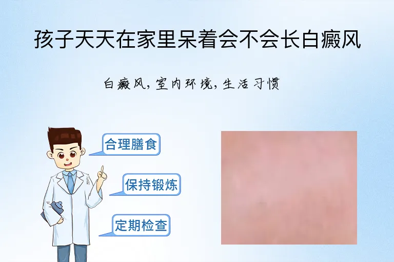 孩子天天在家里呆着会不会长白癜风