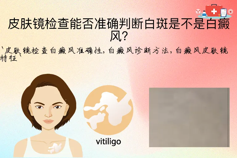 皮肤镜检查能否准确判断白斑是不是白癜风？