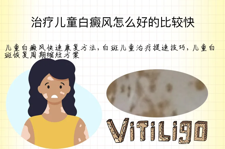 治疗儿童白癜风怎么好的比较快