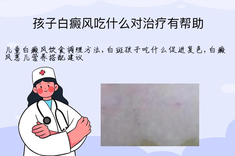 孩子白癜风吃什么对治疗有帮助