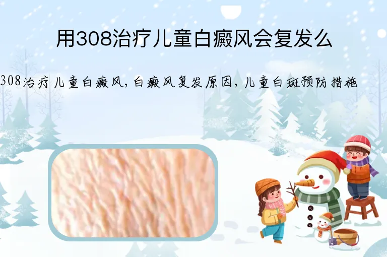 用308治疗儿童白癜风会复发么