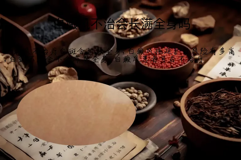 白癜风不治会长满全身吗