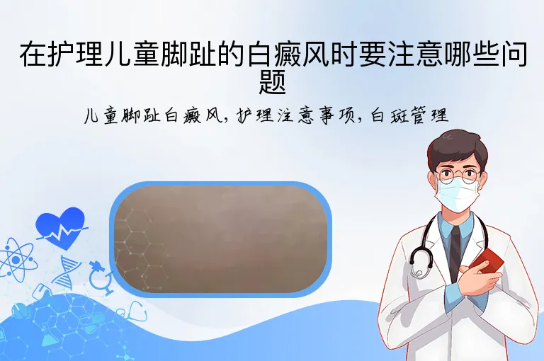 在护理儿童脚趾的白癜风时要注意哪些问题