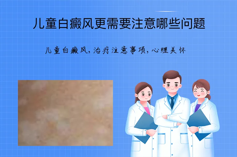 儿童白癜风更需要注意哪些问题