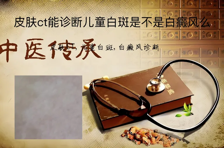皮肤ct能诊断儿童白斑是不是白癜风么