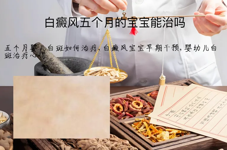 白癜风五个月的宝宝能治吗