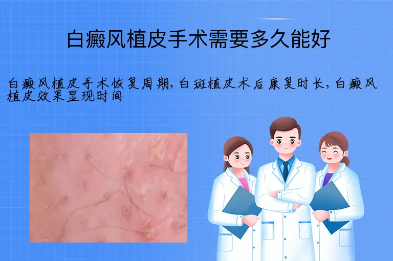 白癜风植皮手术需要多久能好