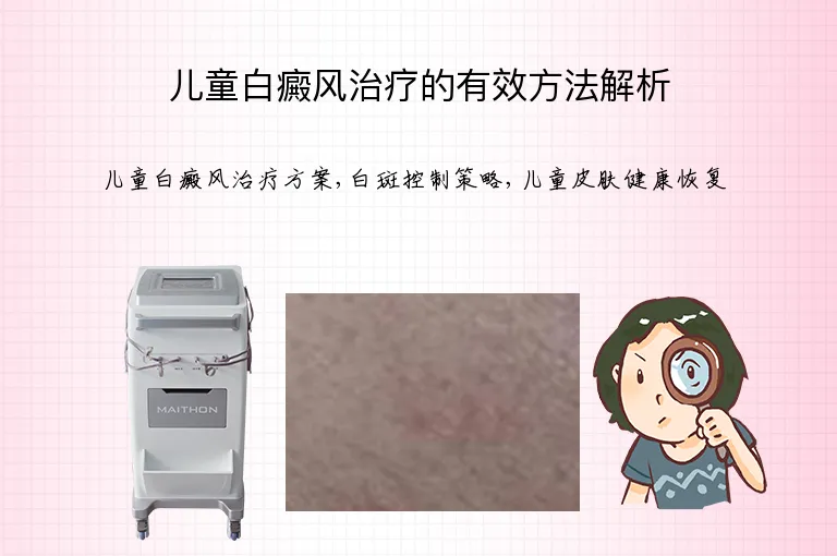 儿童白癜风治疗的有效方法解析