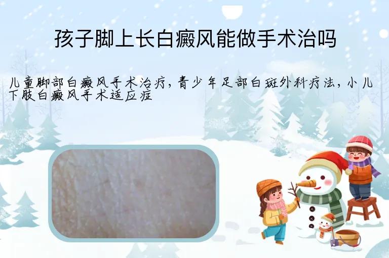 孩子脚上长白癜风能做手术治吗