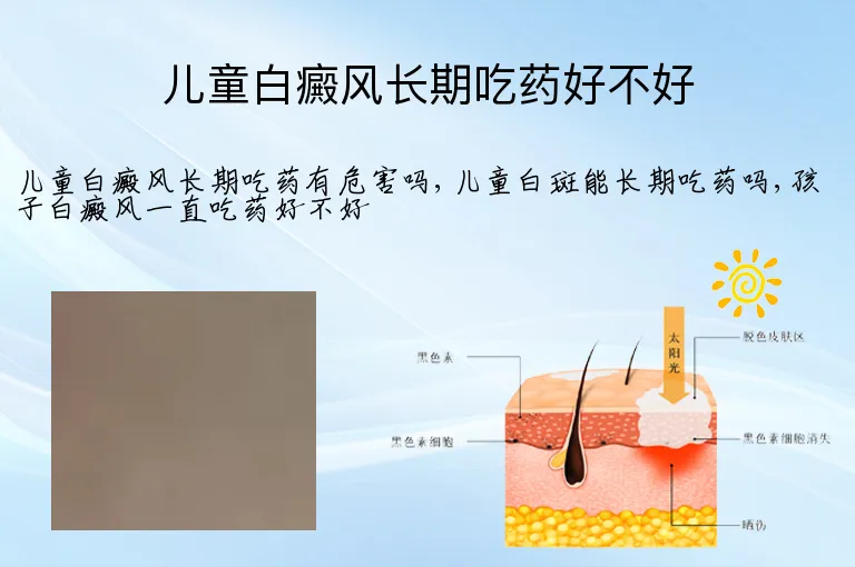 儿童白癜风长期吃药好不好