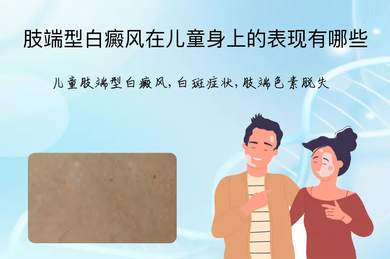 肢端型白癜风在儿童身上的表现有哪些