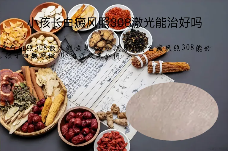 小孩长白癜风照308激光能治好吗
