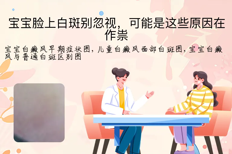宝宝脸上白斑别忽视，可能是这些原因在作祟