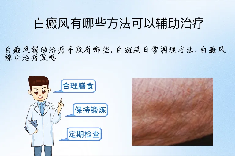 白癜风有哪些方法可以辅助治疗