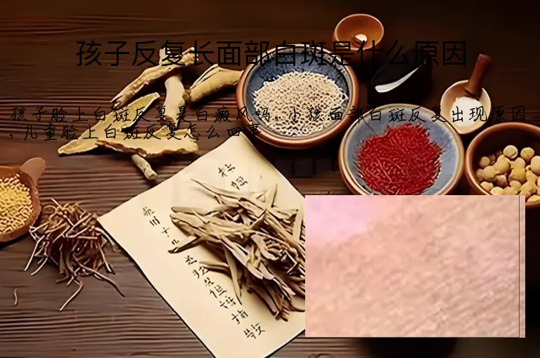 孩子反复长面部白斑是什么原因