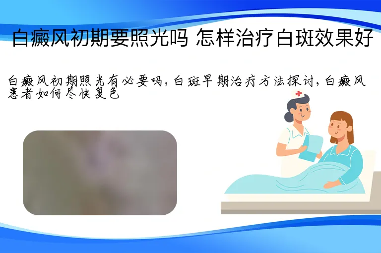 白癜风初期要照光吗 怎样治疗白斑效果好