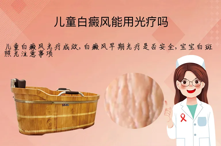 儿童白癜风能用光疗吗