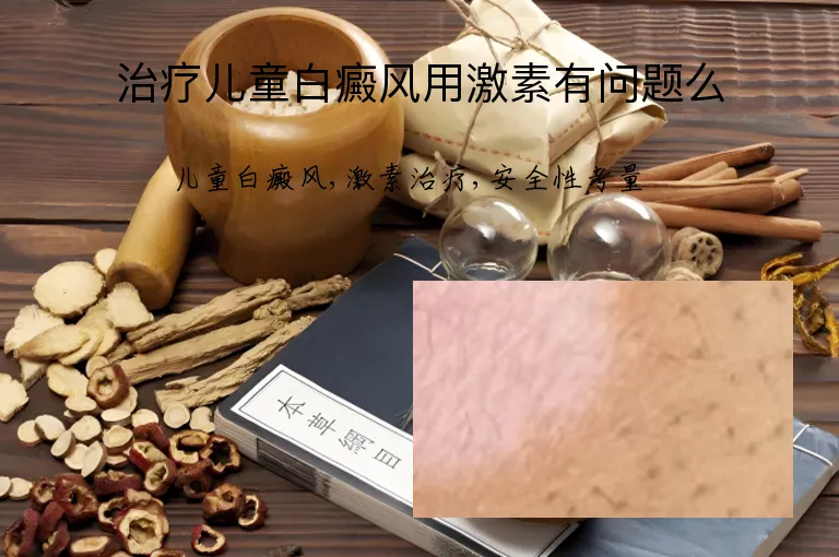 治疗儿童白癜风用激素有问题么