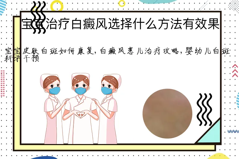 宝宝治疗白癜风选择什么方法有效果