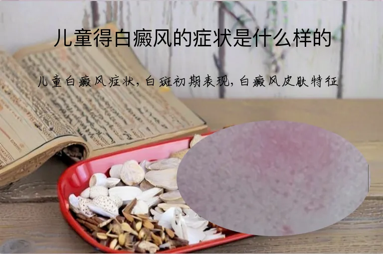 儿童得白癜风的症状是什么样的