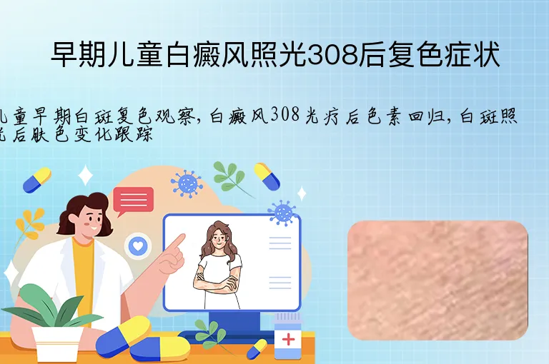 早期儿童白癜风照光308后复色症状