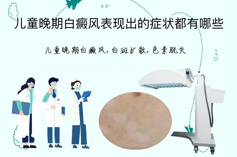 儿童晚期白癜风表现出的症状都有哪些