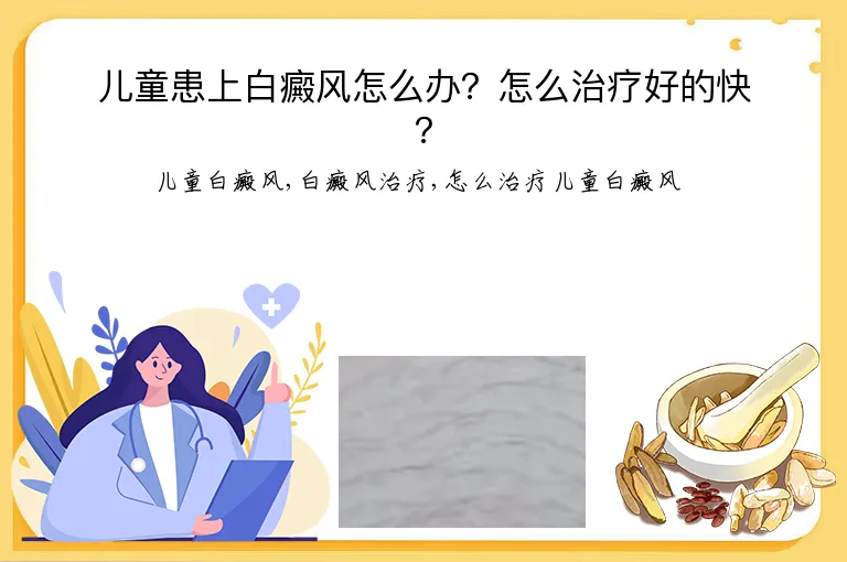 儿童患上白癜风怎么办？怎么治疗好的快？