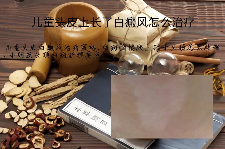 儿童头皮上长了白癜风怎么治疗