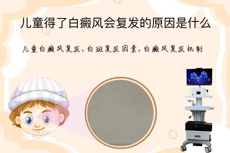 儿童得了白癜风会复发的原因是什么