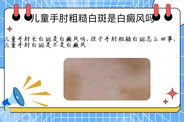 儿童手肘粗糙白斑是白癜风吗