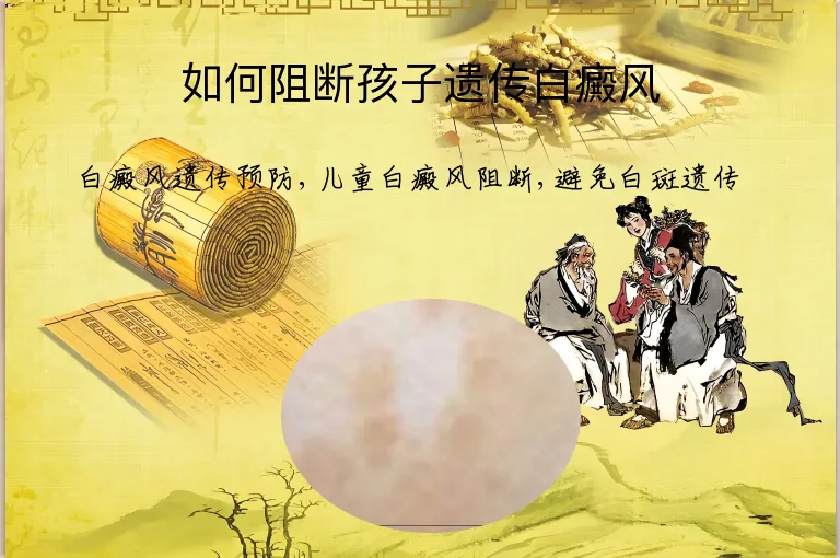 如何阻断孩子遗传白癜风