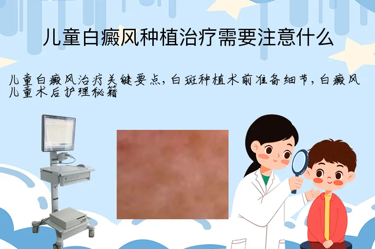 儿童白癜风种植治疗需要注意什么