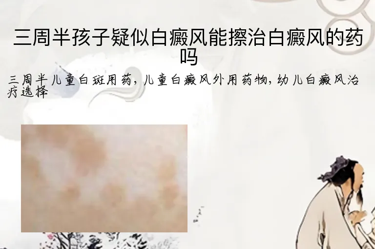 三周半孩子疑似白癜风能擦治白癜风的药吗