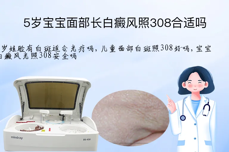5岁宝宝面部长白癜风照308合适吗