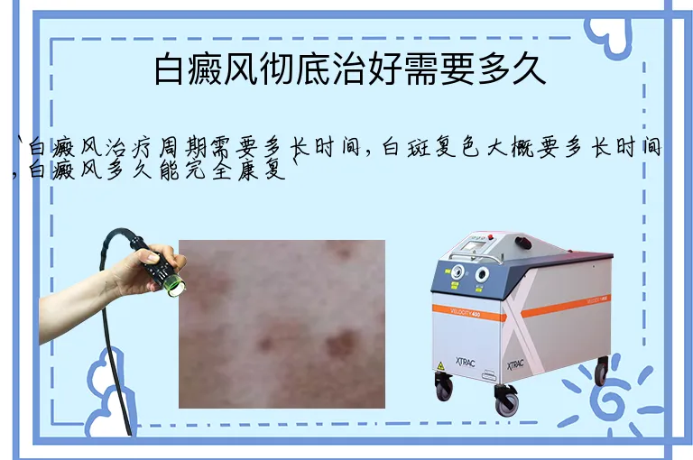 白癜风彻底治好需要多久