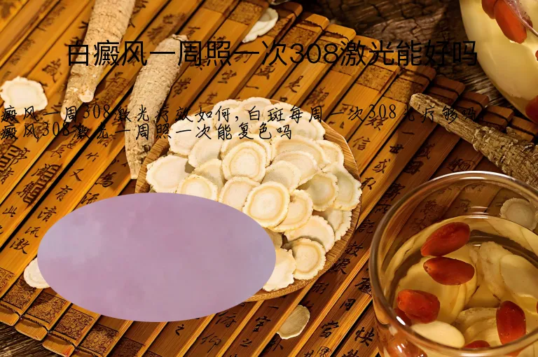 白癜风一周照一次308激光能好吗
