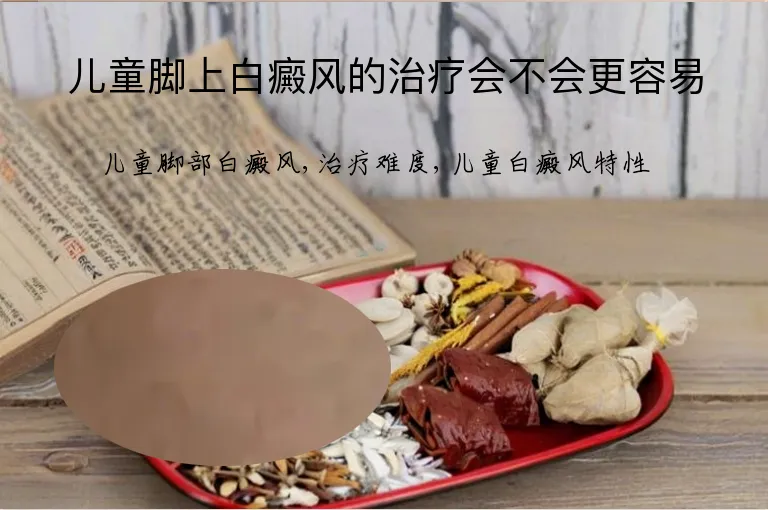 儿童脚上白癜风的治疗会不会更容易