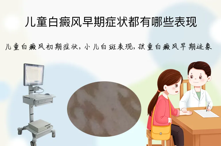 儿童白癜风早期症状都有哪些表现